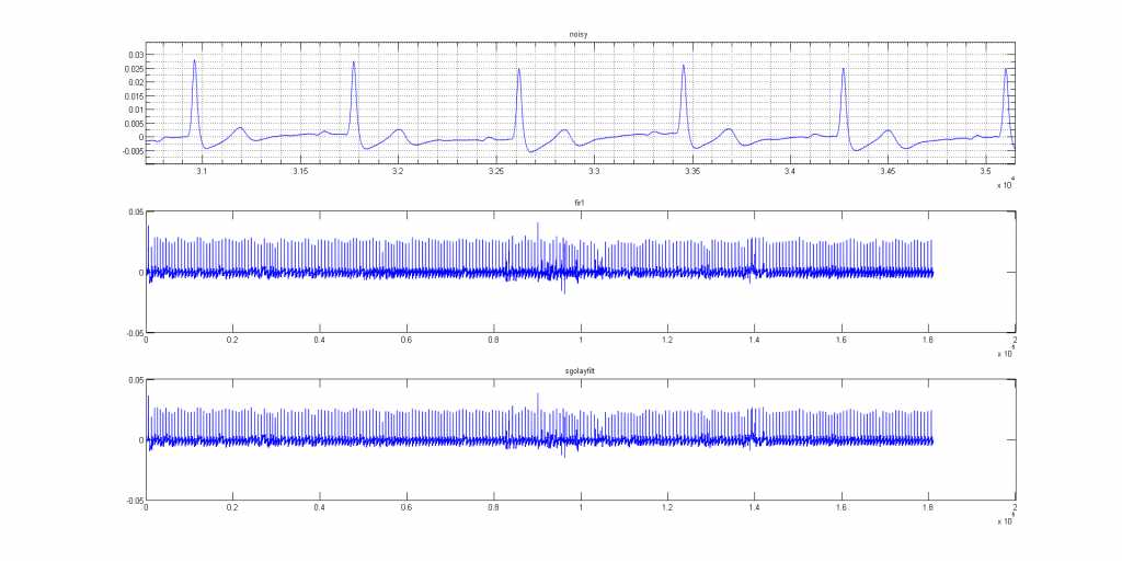 ECG on android